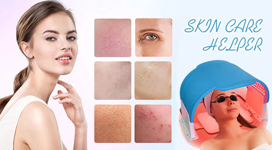 Red Light Therapy: Easing Redness After Cosmetic Laser Treatments