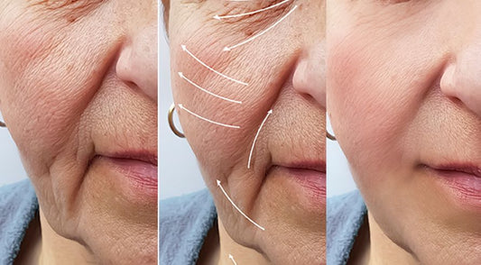 light therapy-wrinkle-skin-rejvenation