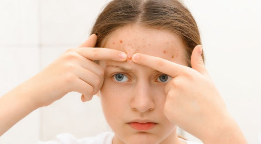 The Triggers of Seborrheic Dermatitis: Insights from Recent Research