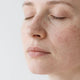 Understanding Dermatitis and Facial Hyperpigmentation: Mechanisms, Types, and Management