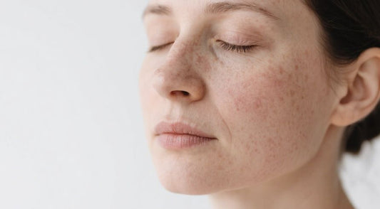 Understanding Dermatitis and Facial Hyperpigmentation: Mechanisms, Types, and Management