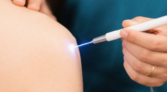 laser acupuncture-pain
