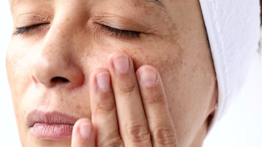 melasma-LED mask-light