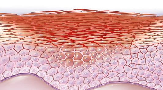 chronic inflammation-disease-body