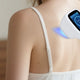laser-308nm-skin-mechanism
