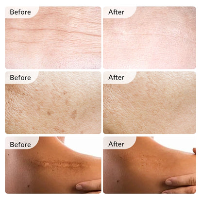 Red Light Therapy Belt - Pain relief for joint at home,outdoors, Relax muscle