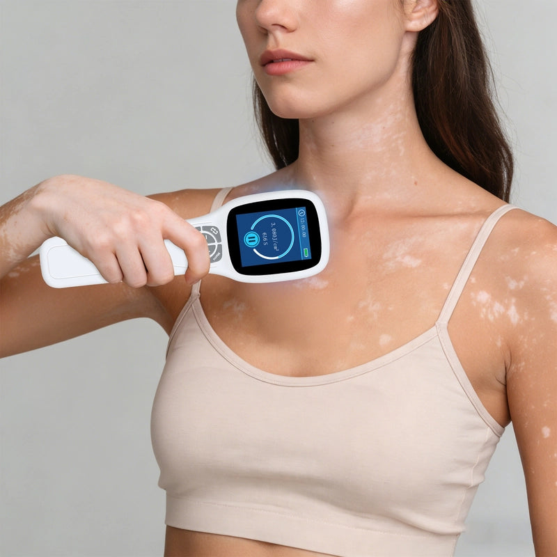 Handheld Excimer UVB Light Therapy 308nm Home Phototherapy Device –Relief for Vitiligo, Psoriasis & Dermatitis
