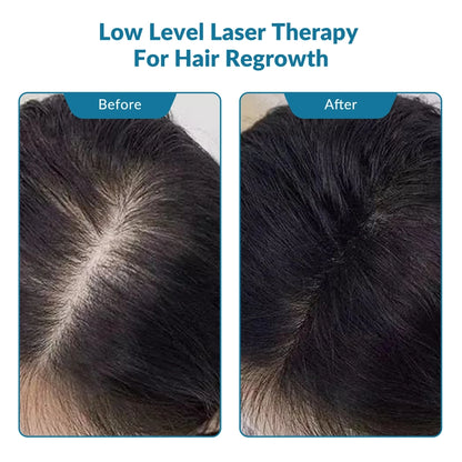 ZJKC 650nm Red Light Therapy Laser for Hair Regrowth Hair Loss Treatment Helmet