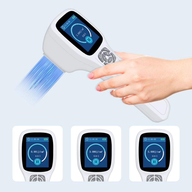 Handheld Excimer UVB Light Therapy 308nm Home Phototherapy Device –Relief for Vitiligo, Psoriasis & Dermatitis