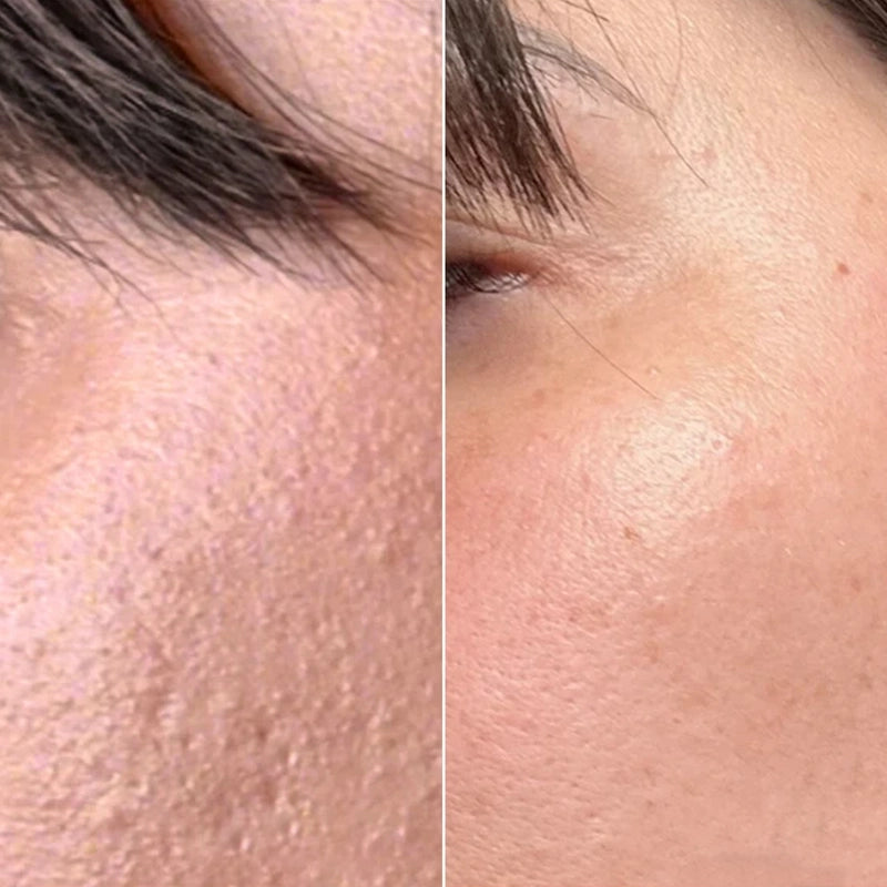 improve_skin_color_result_result 8.19