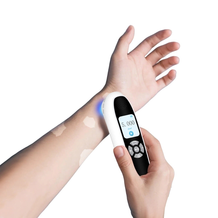 Handheld 308nm Excimer UVB Lamp – High Intensity, High Targeting Light Therapy for Vitiligo