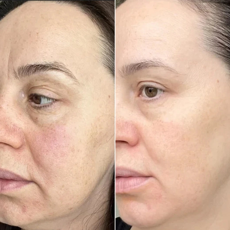 treatments_for_skin_texture_result_result 8.19